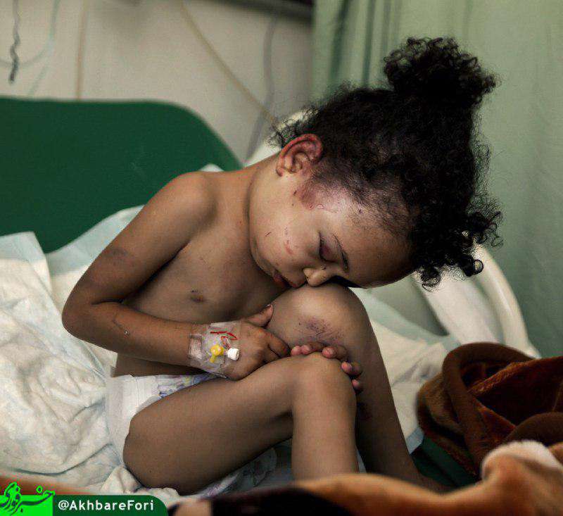 تصویری از بثینه؛ تنها بازمانده خانواده قتل عام شده در حمله هفته پیش ائتلاف سعودی به یمن